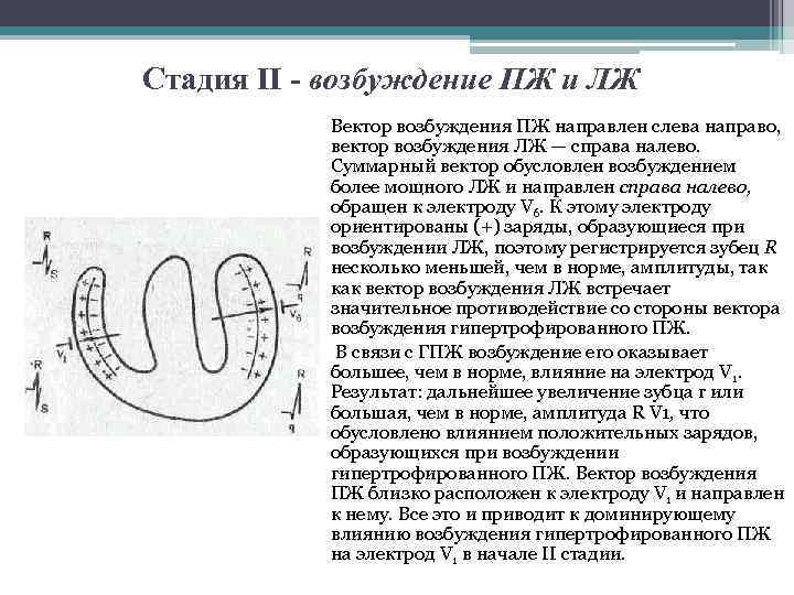 Стадия II - возбуждение ПЖ и ЛЖ Вектор возбуждения ПЖ направлен слева направо, вектор