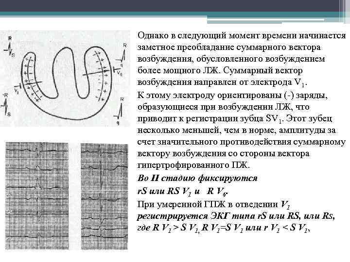 Однако в следующий момент времени начинается заметное преобладание суммарного вектора возбуждения, обусловленного возбуждением более