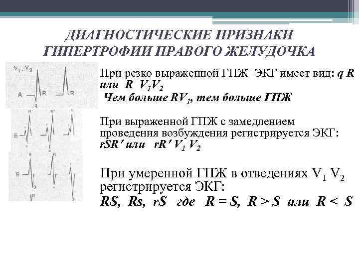 ДИАГНОСТИЧЕСКИЕ ПРИЗНАКИ ГИПЕРТРОФИИ ПРАВОГО ЖЕЛУДОЧКА При резко выраженной ГПЖ ЭКГ имеет вид: q R