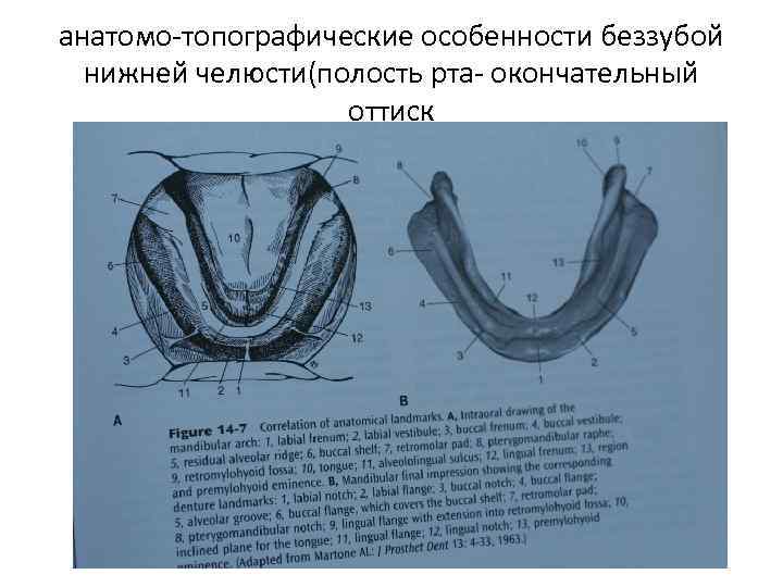 анатомо-топографические особенности беззубой нижней челюсти(полость рта- окончательный оттиск 