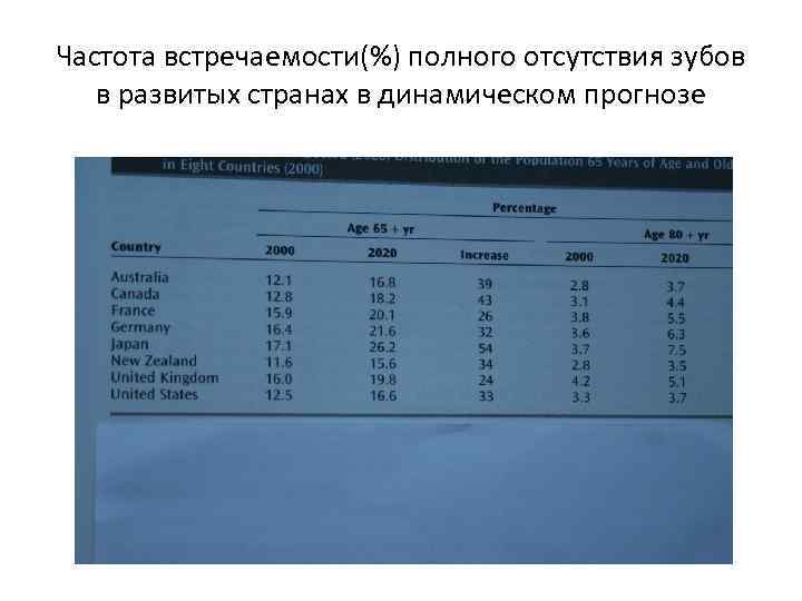 Частота встречаемости(%) полного отсутствия зубов в развитых странах в динамическом прогнозе 