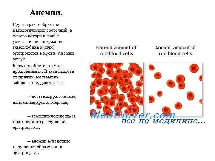 Анемии. Группа разнообразных патологических состояний, в основе которых лежит уменьшение содержания гемоглобина и (или)