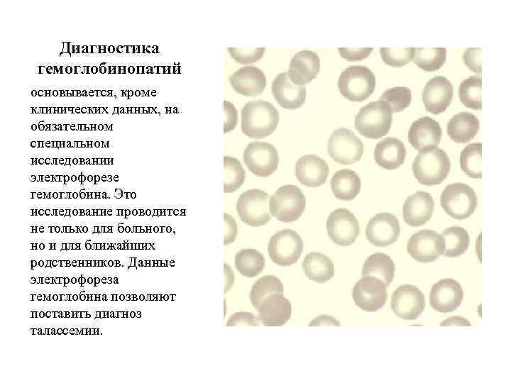 Диагностика гемоглобинопатий основывается, кроме клинических данных, на обязательном специальном исследовании электрофорезе гемоглобина. Это исследование