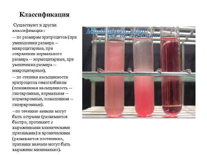 Классификация Существуют и другие классификации : -- по размерам эритроцитов (при уменьшении размера -микроцитарные,