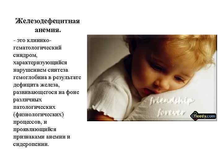 Железодефецитная анемия. - это клиникогематологический синдром, характеризующийся нарушением синтеза гемоглобина в результате дефицита железа,