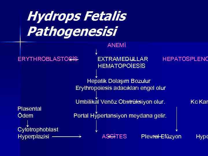 Hydrops Fetalis Pathogenesisi ANEMİ ERYTHROBLASTOSİS EXTRAMEDULLAR HEMATOPOİESİS HEPATOSPLENO Hepatik Dolaşım Bozulur Erythropoiesis adacıkları engel