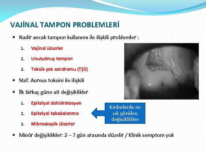 VAJİNAL TAMPON PROBLEMLERİ § Nadir ancak tampon kullanımı ile ilişkili problemler : 1. Vajinal