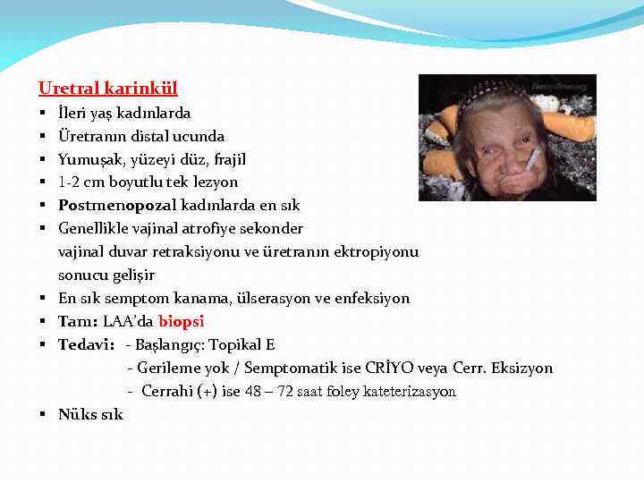 Uretral karinkül § § § § § İleri yaş kadınlarda Üretranın distal ucunda Yumuşak,