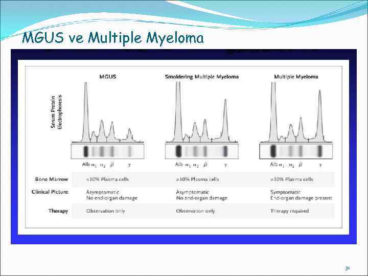 MGUS ve Multiple Myeloma 31 