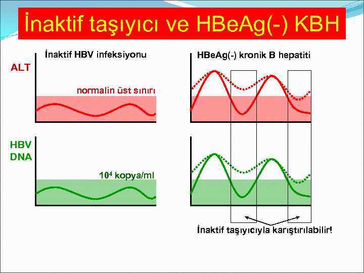 İnaktif taşıyıcı ve HBe. Ag(-) KBH İnaktif HBV infeksiyonu HBe. Ag(-) kronik B hepatiti