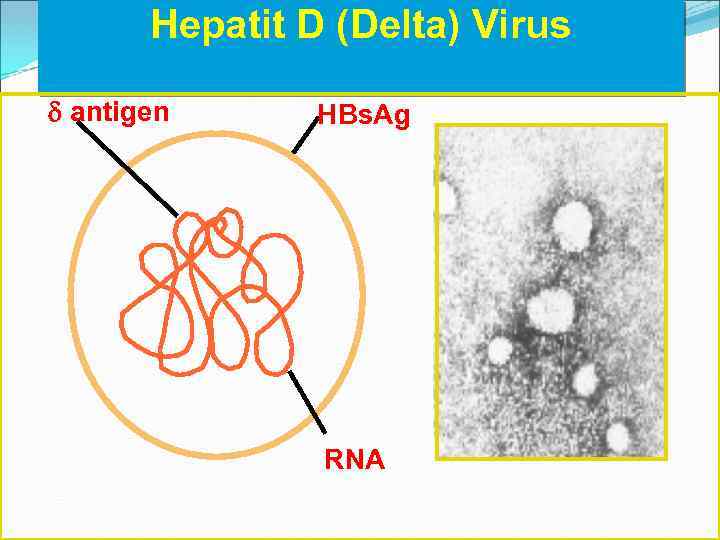 Hepatit D (Delta) Virus d antigen HBs. Ag RNA 