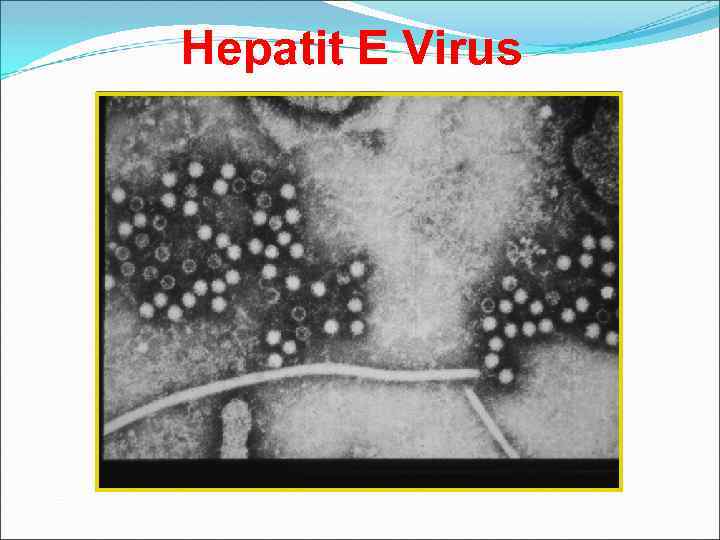 Hepatit E Virus 