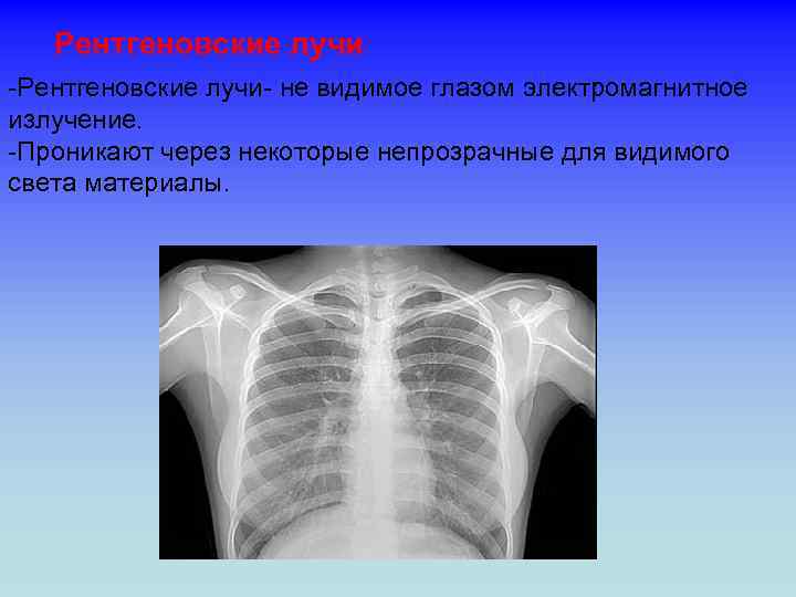 Рентгеновские лучи -Рентгеновские лучи- не видимое глазом электромагнитное излучение. -Проникают через некоторые непрозрачные для