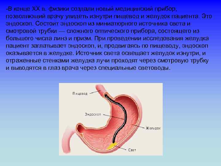 -В конце XX в. физики создали новый медицинский прибор, позволяющий врачу увидеть изнутри пищевод