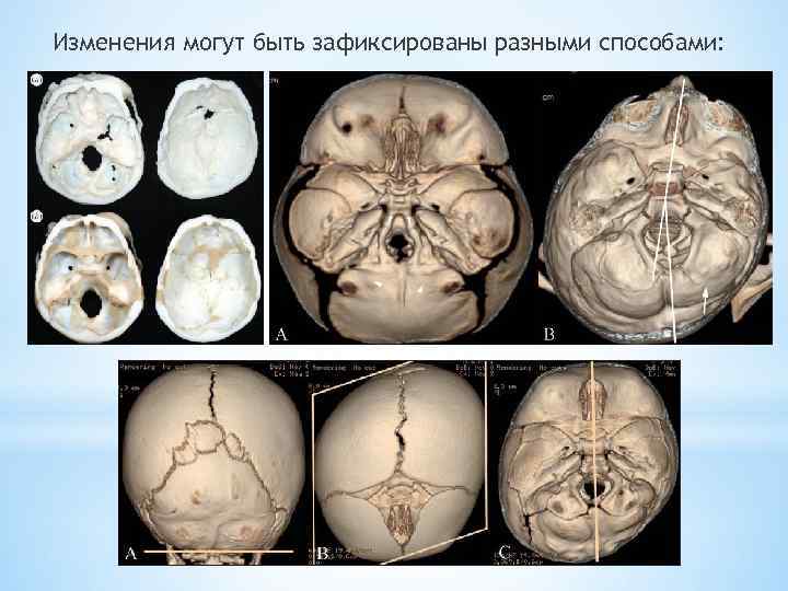 Изменения могут быть зафиксированы разными способами: 