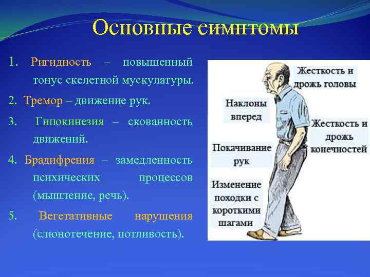 Основные симптомы 1. Ригидность – повышенный тонус скелетной мускулатуры. 2. Тремор – движение рук.