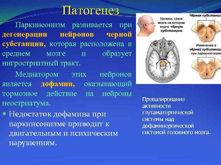 Патогенез Паркинсонизм развивается при дегенерации нейронов черной субстанции, которая расположена в среднем мозге и