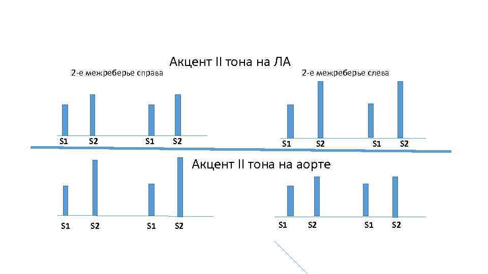 2 -e межреберье справа S 1 S 2 S 1 Акцент II тона на