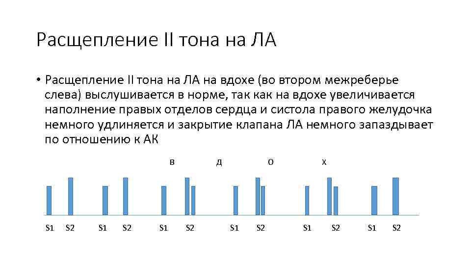 Расщепление II тона на ЛА • Расщепление II тона на ЛА на вдохе (во