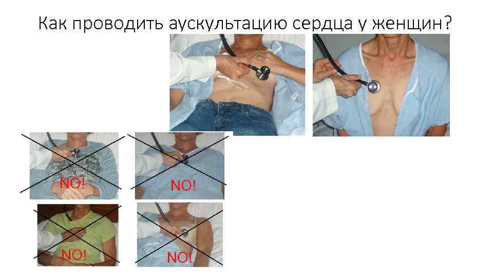 Как проводить аускультацию сердца у женщин? 