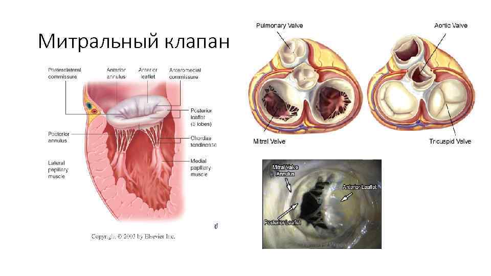 Митральный клапан 