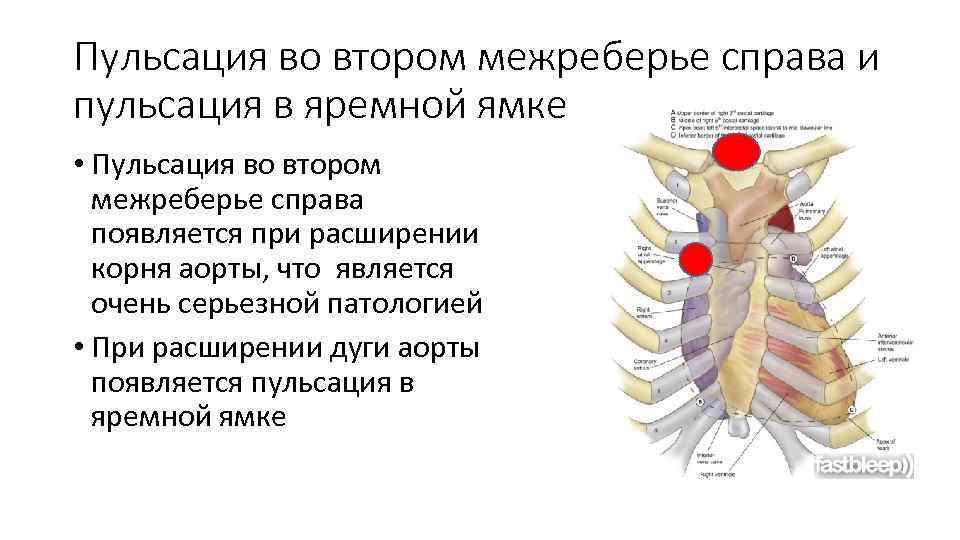 Пульсация во втором межреберье справа и пульсация в яремной ямке • Пульсация во втором