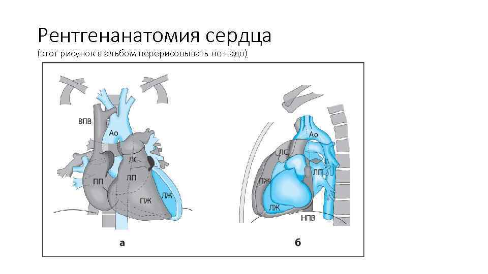 Рентгенанатомия сердца (этот рисунок в альбом перерисовывать не надо) 