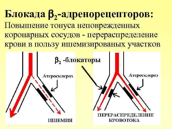 Блокада 2 -адренорецепторов: Повышение тонуса неповрежденных коронарных сосудов - перераспределение крови в пользу ишемизированых