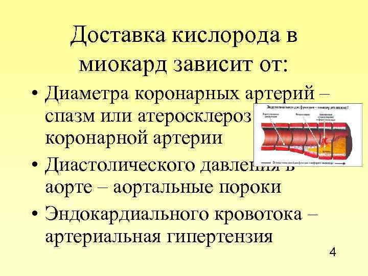 Доставка кислорода в миокард зависит от: • Диаметра коронарных артерий – спазм или атеросклероз