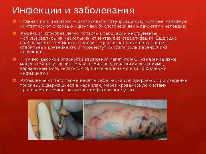 Инфекции и заболевания Главная причина этого – инструменты татуировщиков, которые напрямую контактируют с кровью