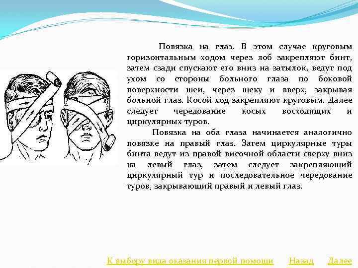  Повязка на глаз. В этом случае круговым горизонтальным ходом через лоб закрепляют бинт,