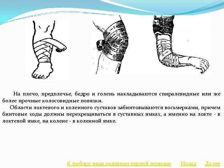 Наложить повязку на предплечье. Колосовидная повязка на локтевой сустав. Спиральная повязка на голень и бедро. Спиральная повязка на плечо и предплечье. Колосовидная повязка на предплечье.