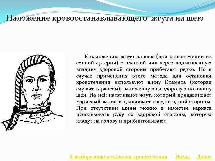 Наложение кровоостанавливающего жгута на шею К наложению жгута на шею (при кровотечении из сонной