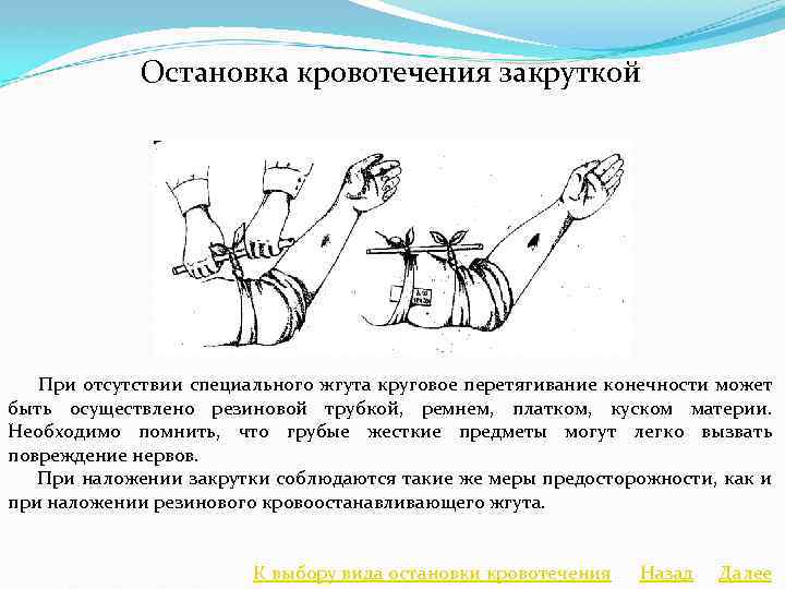 Для остановки кровотечения применяется. Остановка артериального кровотечения закруткой. Метод остановки артериального кровотечения закруткой. Остановка артериального кровотечения жгутом или закруткой. Остановка кровотечения жгутом-закруткой.