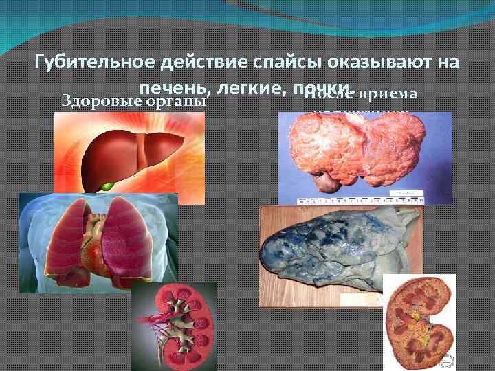 Губительное действие спайсы оказывают на печень, легкие, почки. После приема Здоровые органы наркотиков 