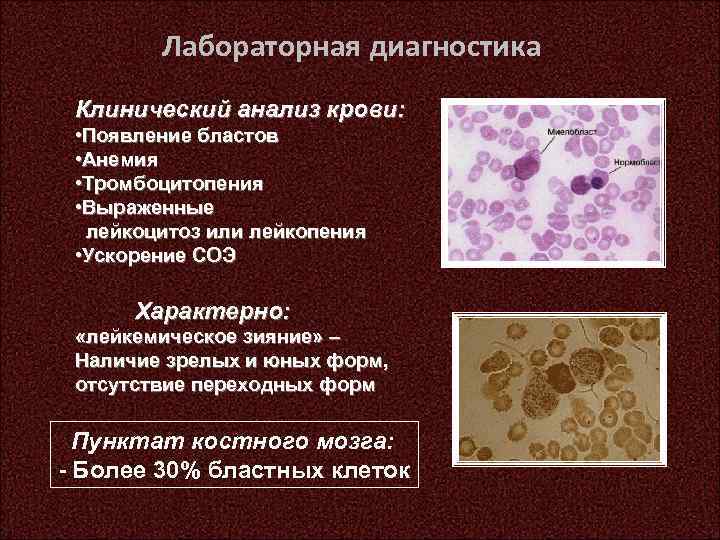 Тромбоцитопения в анализе крови