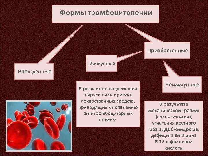 3 тромбоцитопения. Иммунная форма тромбоцитопении. Тромбоцитопения классификация. Виды иммунной тромбоцитопении. Тромбоцитопения этиология.