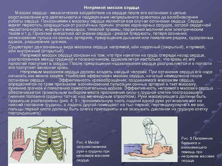  Непрямой массаж сердца Массаж сердца - механическое воздействие на сердце после его остановки