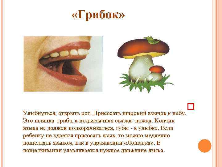  «Грибок» Улыбнуться, открыть рот. Присосать широкий язычок к небу. Это шляпка гриба, а