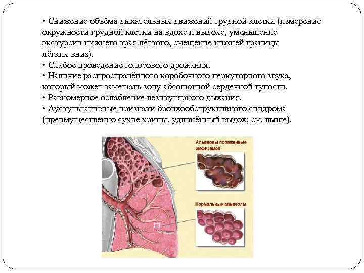  • Снижение объёма дыхательных движений грудной клетки (измерение окружности грудной клетки на вдохе