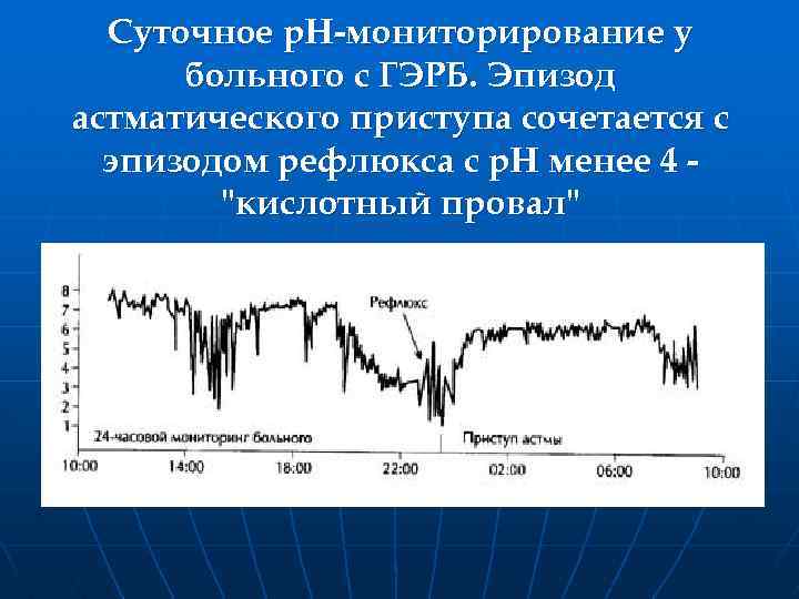 Суточное р. Н-мониторирование у больного с ГЭРБ. Эпизод астматического приступа сочетается с эпизодом рефлюкса