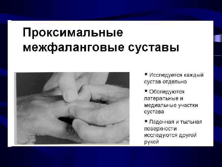 Суставной синдром презентация