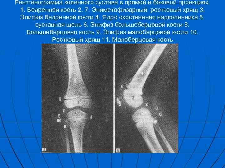 Окостенение головки бедренной кости. Добавочные кости коленного сустава рентген. Дистальный эпифиз большеберцовой кости. Точка окостенения надколенника Возраст.