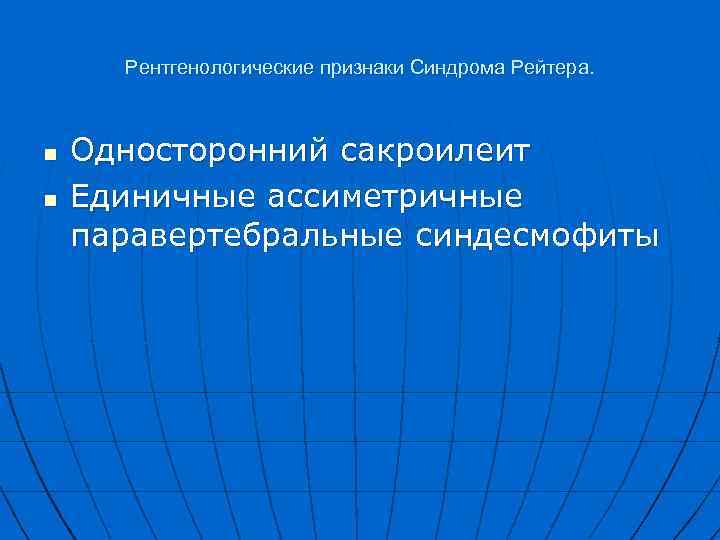 Рентгенологические признаки Синдрома Рейтера. n n Односторонний сакроилеит Единичные ассиметричные паравертебральные синдесмофиты 