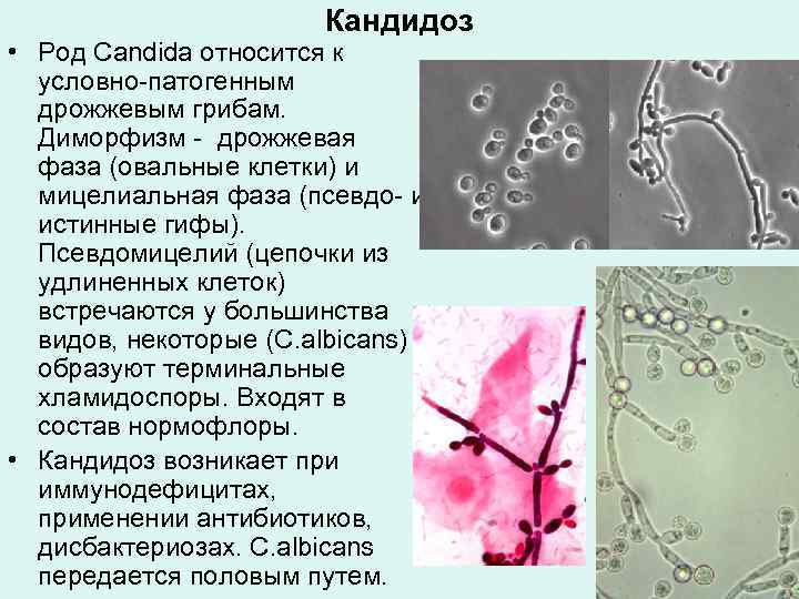 Кандидоз * Род Candida относится к условно-патогенным дрожжевым грибам. 