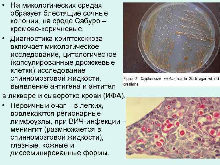  • На микологических средах образует блестящие сочные колонии, на среде Сабуро – кремово-коричневые.