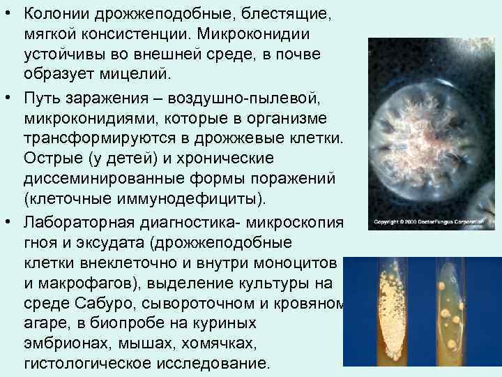  • Колонии дрожжеподобные, блестящие, мягкой консистенции. Микроконидии устойчивы во внешней среде, в почве