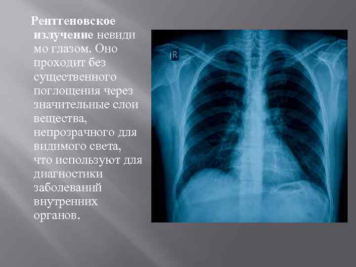 Рентгеновское излучение невиди мо глазом. Оно проходит без существенного поглощения через значительные слои вещества,