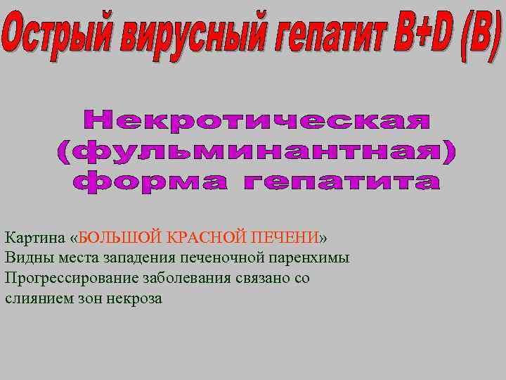 Картина «БОЛЬШОЙ КРАСНОЙ ПЕЧЕНИ» Видны места западения печеночной паренхимы Прогрессирование заболевания связано со слиянием