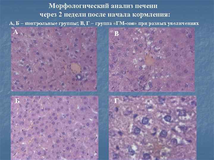 Морфологический анализ печени через 2 недели после начала кормления: А, Б – контрольные группы;